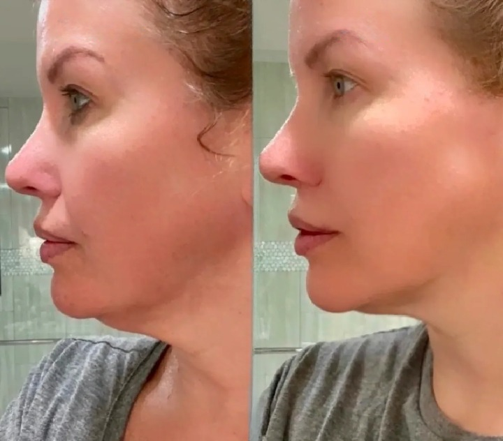 V-Lift Sculpt