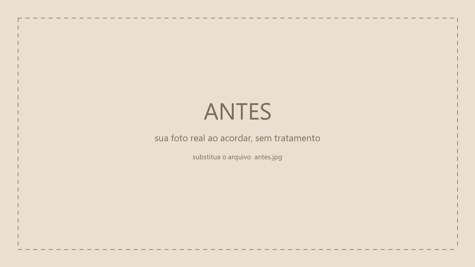 Antes